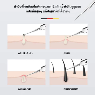 ที่กดสิว ที่ดึงสิวเสี้ยน มี 4 ชิ้น คุณภาพสูง ไม่ขึ้นสนิมแน่นอน
