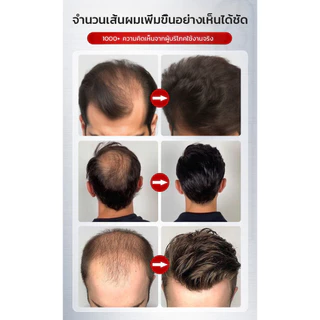 🔥สินค้าขายร้อน🔥COD💥【เห็นผลทันที】สเปรย์เร่งการเจริญเติบโตของเส้นผมจากธรรมชาติ 100% / สเปรย์บำรุงผมแบบไม่ต้องล้างออก / สเปรย์น้ำหอมแบบไม่ต้องล้างออก / กระตุ้นการงอกของเส้นผมใหม่ / แก้ปัญหาผมร่วงและผมบาง / เหมาะสำหรับทุกเพศทุกวัย