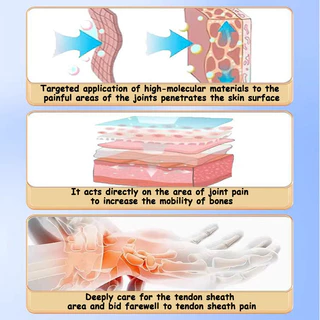 แผ่นแปะ Tenosynovitis กล่องละ 12 ปวดข้อมือ ชานิ้ว เสียงข้อผิดปกติ แก๊งเลียน ไซสต์ เร็ว มีประสิทธิภาพและบรรเทาอาการปวดยาวนาน