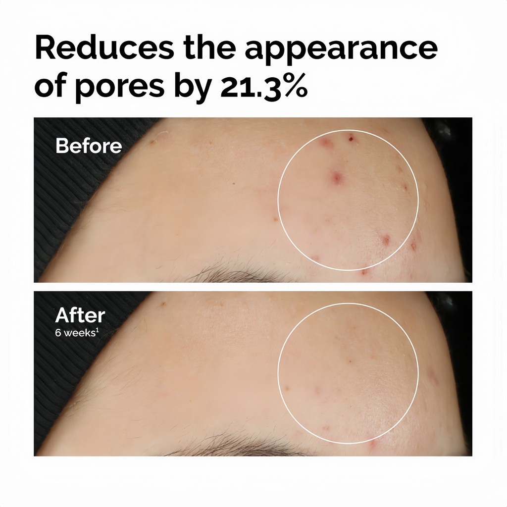 The Ordinary Balancing & Clarifying Serum 30ml | เซรั่มกระชับรูขุมขน คุมมัน ผิวเรียบเนียน กระจ่างใส - รูปที่ 4