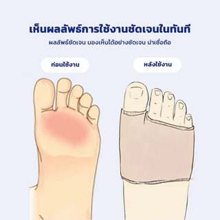 LOFTHOME แผ่นรองฝ่าเท้าด้านหน้า กระจายแรงกด กันลื่น บรรเทาอาการปวดเท้า เดินสบายทั้งวัน ใส่ออกกำลังกายได้