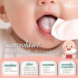 Khun ทิชชู่เปียกเช็ดทำความสะอาดช่องปากสำหรับเด็ก Oral Wipe เช็ดลิ้น เหงือก ฟัน กระพุ้งแก้ม 20 แผ่น