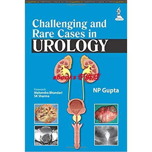 ท้าทายและคดีหายากในเทพนิยาย - NP Gupta