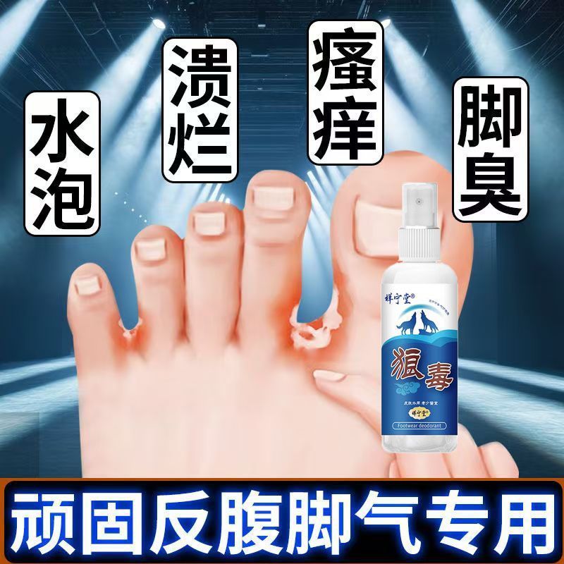 New Product#Itchy soles, itchy insteps, peeling feet, blisters, itchy blisters, itchy toe gaps, ulce