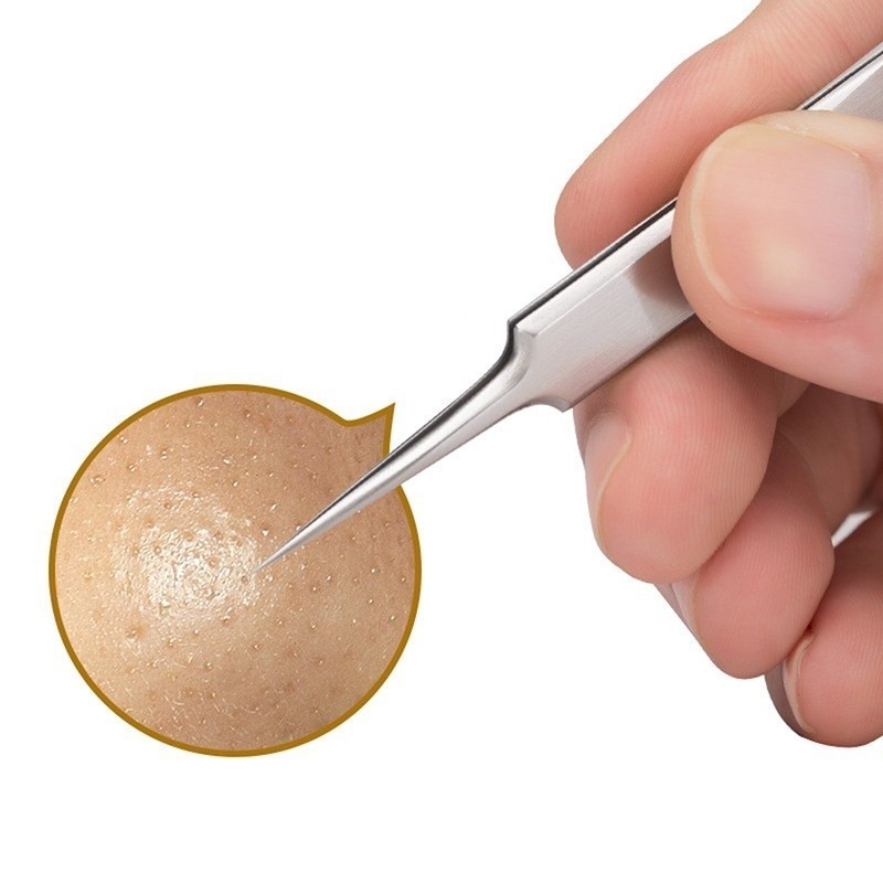 แหนบรักษาสิว 4 ชิ้น/เซ็ต, คลิปเซลล์ที่คมชัดเป็นพิเศษสําหรับการกําจัดสิวหัวดํา, เครื่องมือความงามที่มีความแม่นยํา - รูปที่ 5