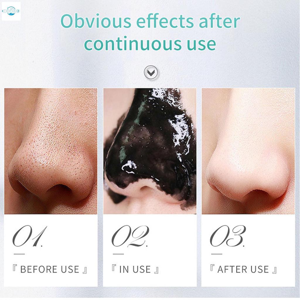 ทําความสะอาดรูขุมขนหน้ากากจมูกสิวหัวดําลบหน้ากากสูตรปลอดภัยสําหรับรักษาสิวดูแลผิว - รูปที่ 7