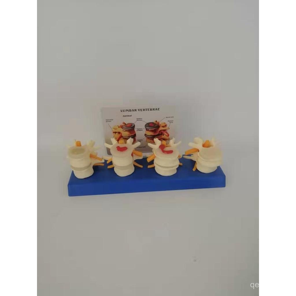 โรงงานขายตรงร่างกายมนุษย์รุ่นกระดูกสันหลังกระดูกสันหลังแผ่นดิสก์โรครุ่นกายวิภาคศาสตร์กระดูก N5UC