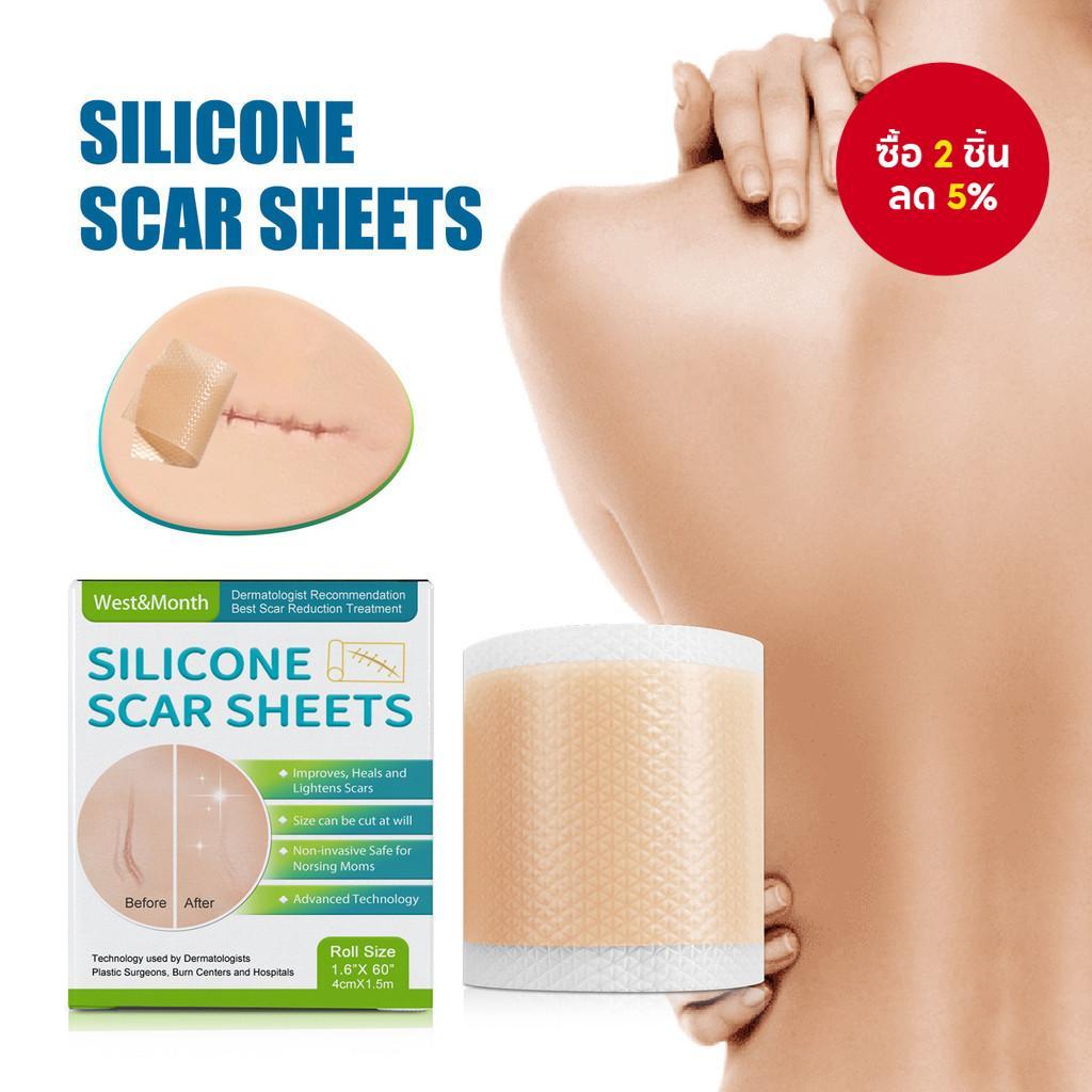 West&Month Silicone Scar Sheets Repair The Growth Lines Of Peel Smooth Skin