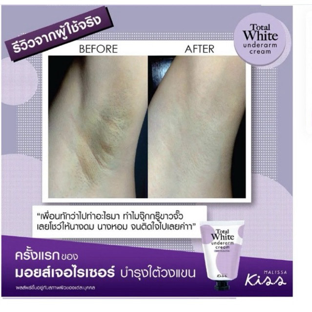 ครีมรักแร้ขาว มาริสา คิดส์Malissa Kiss Total White Underarm Cream 30ml.