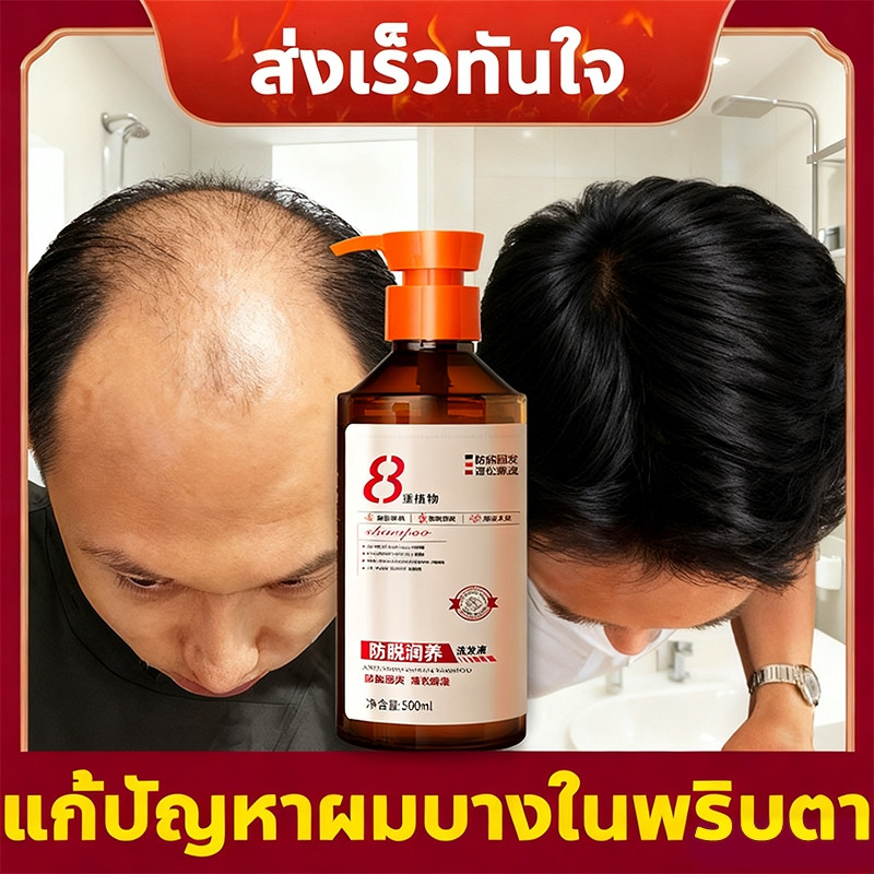 ส่งเสริมแชมพูสระผมแชมพูป้องกันผมร่วงส่วนผสมขิงบํารุงหนังศีรษะสดชื่นอ่อนไม่ระคายเคืองเร่งการเจริญเติบโตของเส้นผมป้องกันผมร่วง