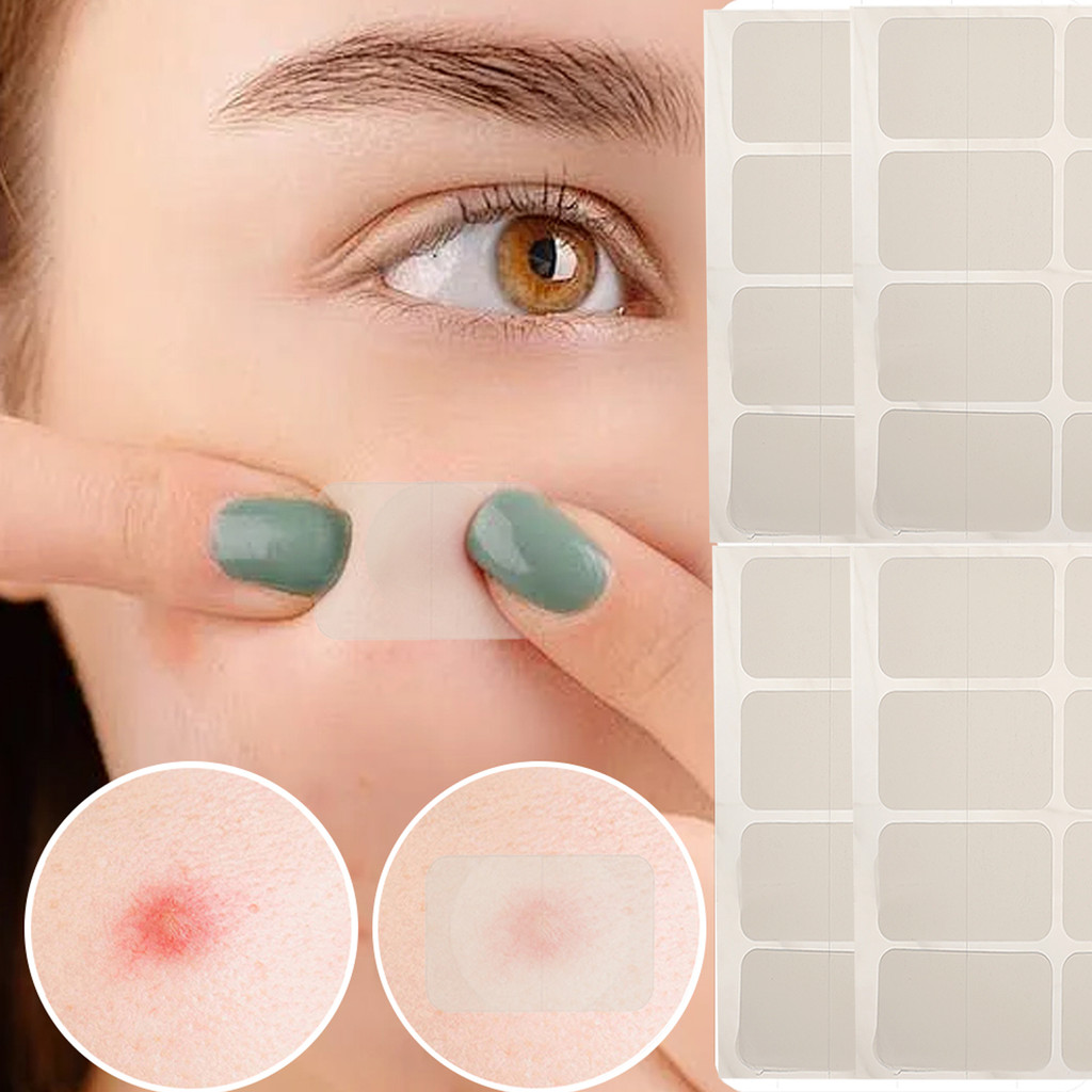 ป้องกันการติดเชื้อแบคทีเรีย แผ่นแปะสิว T-zone ระบายอากาศได้ - Removal Pimple Spot Marks สติ๊กเกอร์ซ่อมแซมขนาดใหญ่