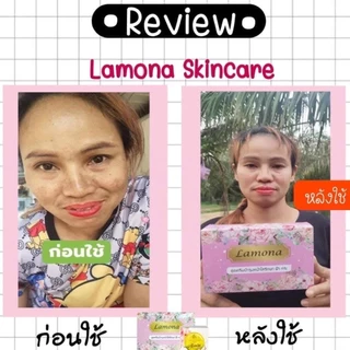 [เซ็ต 10 ชุดสุดคุ้ม] ครีมลาโมน่า Lamona เซ็ตครีมบำรุงผิว ลดฝ้ากระจุดด่างดำ มีของแถมทุกชุด