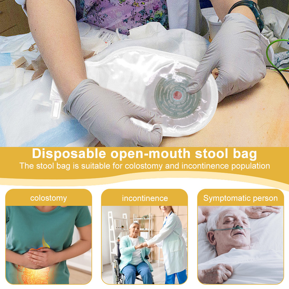TH จัดส่งจากประเทศไทย ถุงเก็บอุจจาระ ถุงอึแบบชิ้นเดียว ขนาด 20-60มม. Colostomy Bag - รูปที่ 2