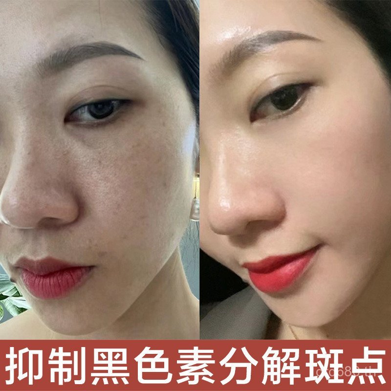 Hydrating Spot Essence Moisturizing Ammonia Removal Acid Tranexamic Acidized Stock Solution Essence 