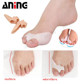 แผ่นเจลฮัลลักซ์วาลกัส อ่อนนุ่ม ความยืดหยุ่นสูง สำหรับการดูแล…