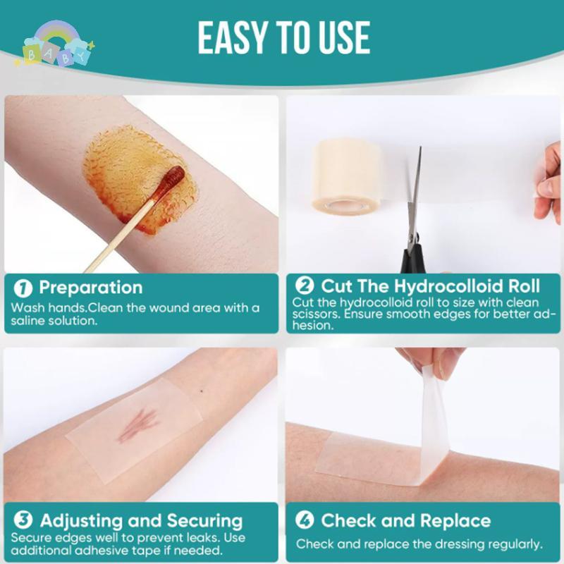 [BB-t] Hydrocolloid Roll สําหรับ Wound Care Hydrocolloid Patch Care Bandages Self-Adhesive Skin Disi