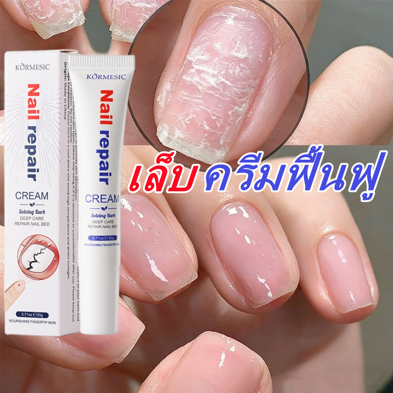 KORMESIC ครีมซ่อมแซมเล็บ(Nail Repair Cream)การดูแลลึก ฟื้นฟูเล็บ ปรับปรุงเล็บที่เสีย ครีมป้องกันเล็บ