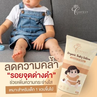 Perfect โลชั่นเด็ก สูตรออร์แกนิค บำรุงผิวขาว กระจ่างใส แก้ปัญหาขาลาย กู้ผิวคล้ำเสีย ลดรอยยุงกัด
