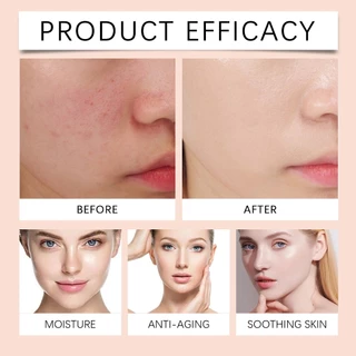 West&Month Moisturizing Facial Cream ครีมขมิ้น ขมิ้นทาหน้า บำรุงผิว ให้ความชุ่มชื้น กระจ่างใส ลดฝ้า กระ จุดด่างดำ 50g