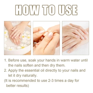 OUHOE เซรั่มบำรุงเล็บ Nail Serum 30ML เล็บเท้าคุด เอสเซนส์ซ่อมแซมเชื้อราที่เล็บ ทำให้เล็บนุ่ม เล็บหนาขึ้น เล็บเรี