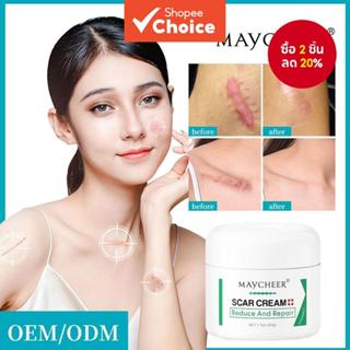 Scar Cloaking Scar Removal Cream Set ฟื้นฟูผิว Confidence