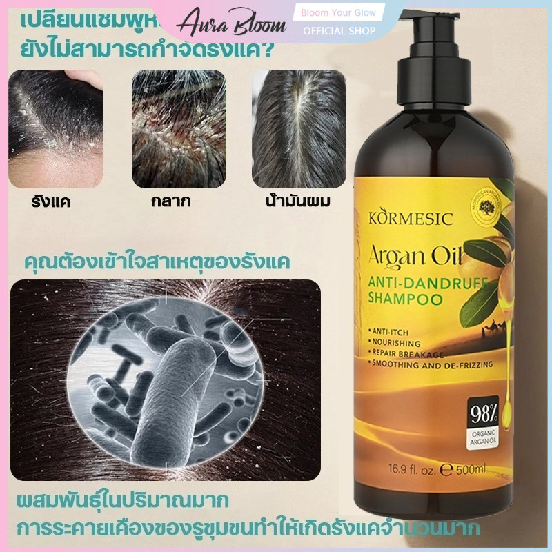 แชมพูขจัดรังแค 500MLยาสระผมเชื้อรา ป้องกันรังแคและลดความมัน บำรุงหนังศรีษะ ลดอาการคันศีรษะ ลดรังแค แชมพูขจัดรังแค