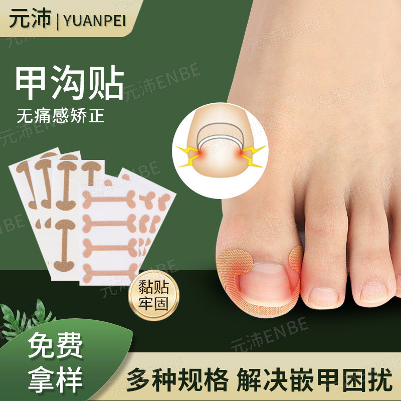 I-Shaped แผ่นแปะเล็บร่องเล็บม้วนด้านในยืดกาวฟรีคุดเล็บToe Padเล็บSelf-Adhesive Correction Patch 26.4