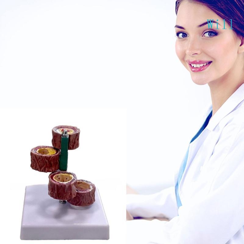 Will Blood Vessel Anatomical Atherosclerosis Models Blood Vessel Anatomical Models