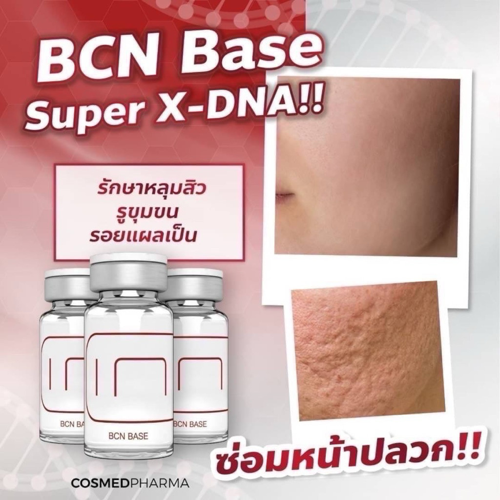 (1 ขวด)BCN หลุมสิว รอยแตกลาย รูขุมขน 5 ml/ขวด