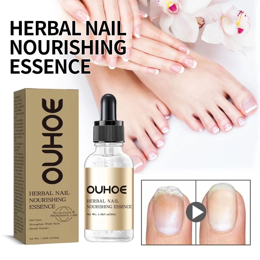 OUHOE เซรั่มบำรุงเล็บ Nail Serum 30ML เล็บเท้าคุด เอสเซนส์ซ่อมแซมเชื้อราที่เล็บ ทำให้เล็บนุ่ม เล็บหนาขึ้น เล็บเรี