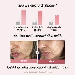 MEDICUBE Serum เมดิคิวบ์ เซรั่มบำรุงผิว 30ml ผิวโกลว์ เสริมความแข็งแรงให้ผิว (Kojic Acid/PDRN Pink /TXA Niacinamide)