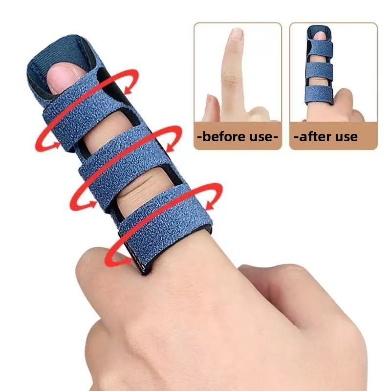 Medical Finger Fixing Splint Sheath ปรับแผ่นอลูมิเนียมรองรับเดี่ยวเข็มขัดป้องกันกีฬาอุปกรณ์ป้องกัน Recovery สายรัดสนับสนุน
