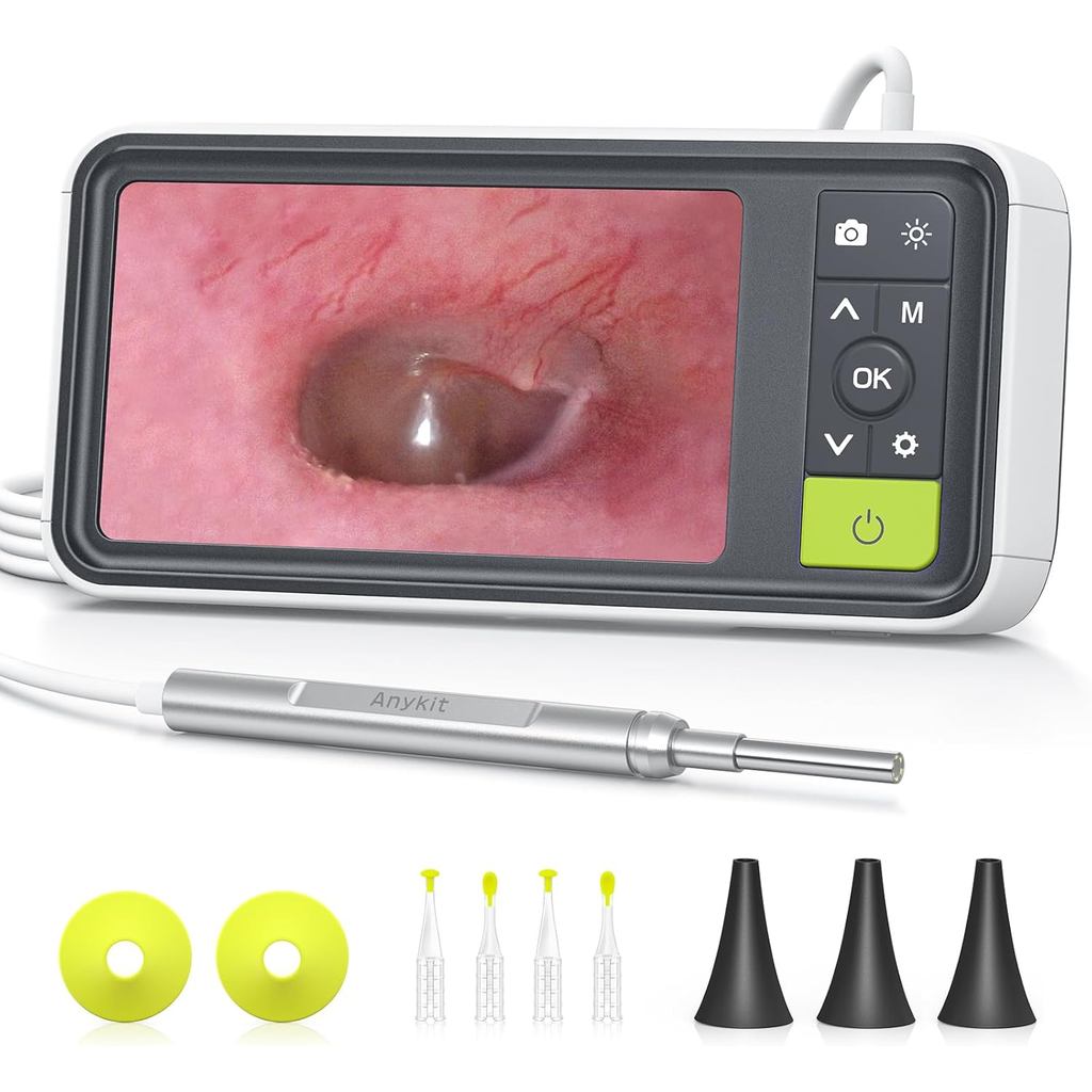 Anykit Digital Otoscope พร้อม Gyroscope, หน้าจอ 4.5 นิ้ว, กล้องขอบเขตหู 3.9 มม. พร้อมไฟ 6 ดวง, เครื่