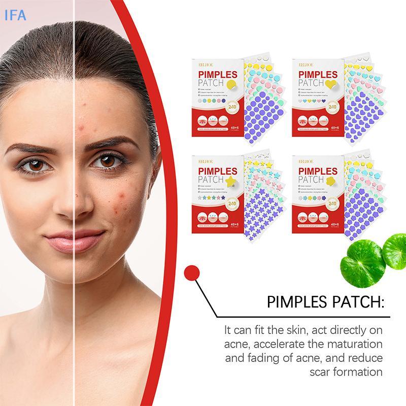 IFA 240 ชิ้น Salicylic Acid Acne PatchStar Pimple Patch สิวที่มีสีสันที่มองไม่เห็น Skin Care สติกเกอ