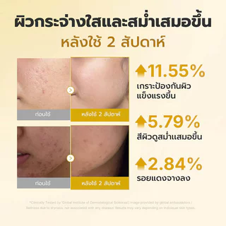 MEDICUBE Kojic Acid Turmeric Niacinamide Serum 30ml เซรั่มบำรุงผิว เมดิคิวบ์ ลดรอยดำ เผยผิวกระจ่างใส เรียบเนียน.