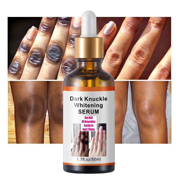 Hand Joint Blackening Brightening Serum Dark Knuckles Whitening S eru