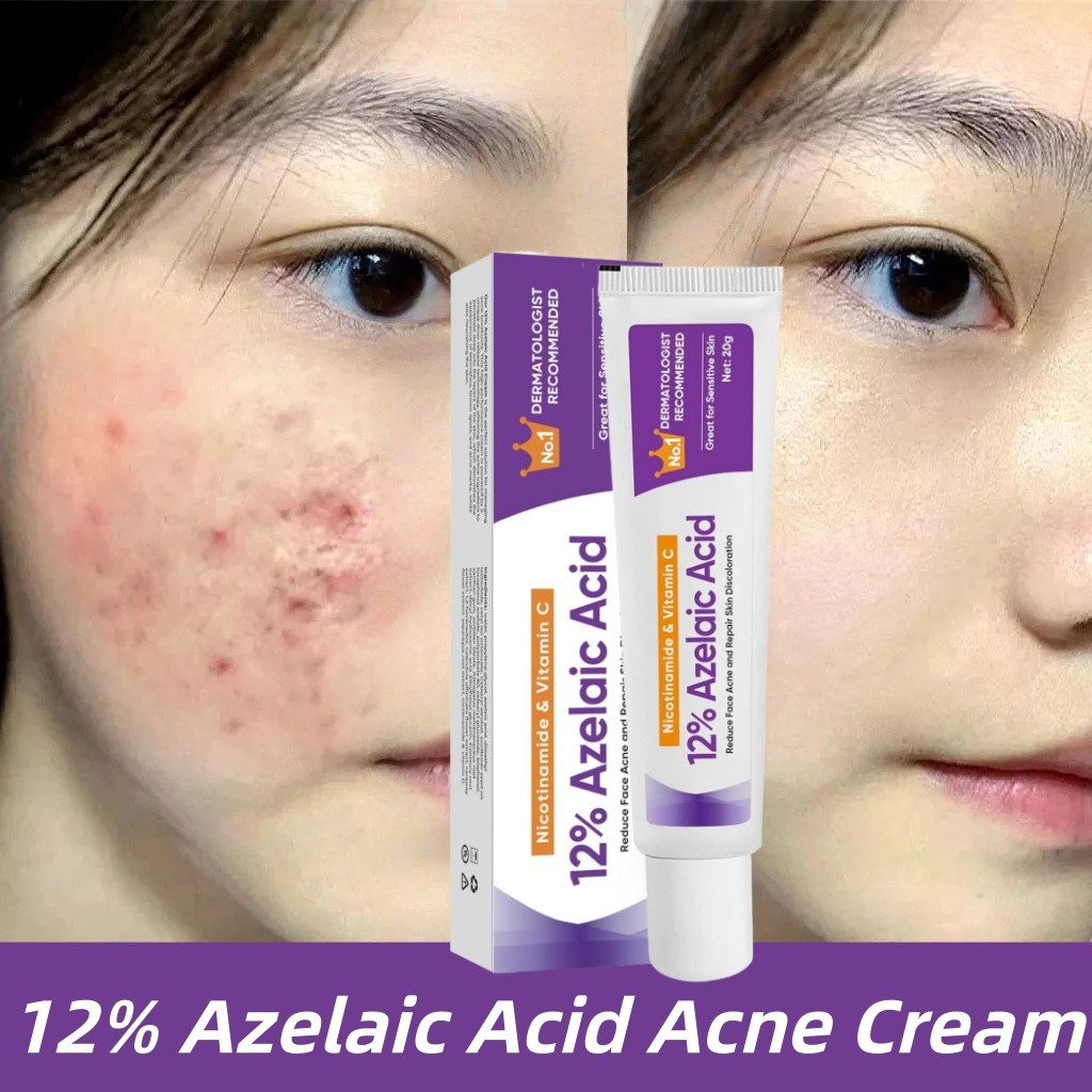 12% Azelaic Acid Cream Face Cream Acne Treatment Skin Care Pimple Scars Remover Repair Skin Redness