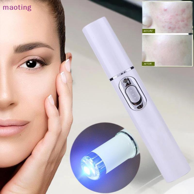[ขายส่ง] ปากกาเลเซอร์สิวแสงสีฟ้า LED Face Light สําหรับรอยแผลเป็นกําจัดริ้วรอย Treatment Skin Care Beauty []