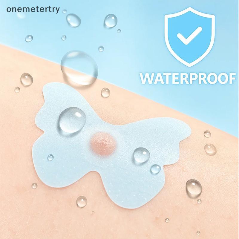 Onem 120/360Pcs ผีเสื้อรูปร่างสิว Pimple Patch สติกเกอร์ Blemish Spot คอนซีลเลอร์ 0.1 มม.สิว Pimple 