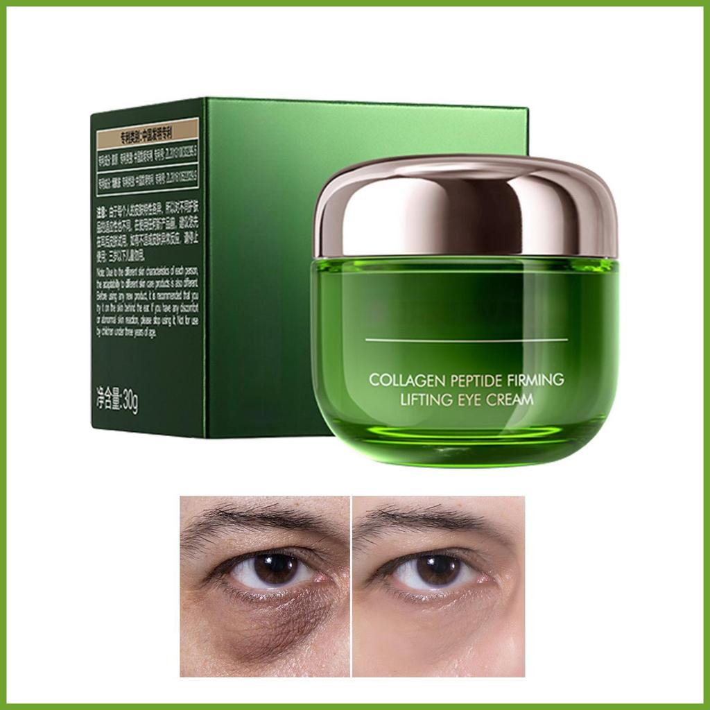 ครีมบํารุงรอบดวงตาครีมบํารุงรอบดวงตาสําหรับ Dark Circles Moisturizing Tighter 30g Balm สําหรับหมองคล