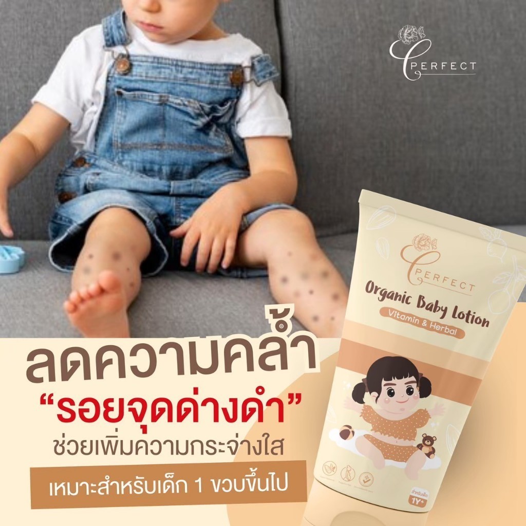 Perfect โลชั่นเด็กบำรุงผิวขาว แก้ปัญหาขาลาย กู้ผิวคล้ำเสีย ลดรอยยุงกัด  สูตรออร์แกนิค