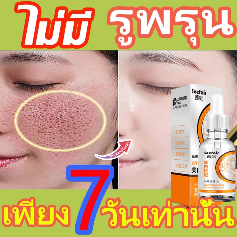 ครีมทาฝ้า ครีมผิวขาว 30ml ครีมถาหน้าขาว ครีมทาฝ้าหนาๆ ช่วยกำจัดฝ้ากระ จุดดำ ฝ้าถูกแดดเผาอย่างเป็นมืออาชีพ ทำให้ผิวขาว