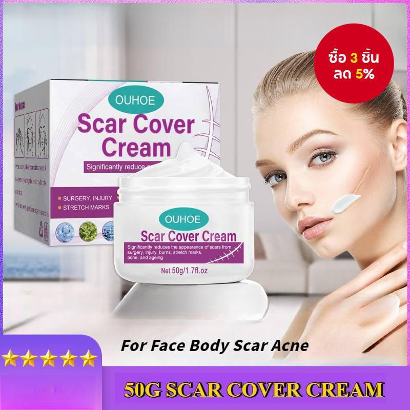 ครีมปกปิดรอยแผลเป็นสําหรับผิวหน้าและผิวกาย - ปกปิดรอยสิว & Stretch Marks, Skin Repair Treatment, Nat