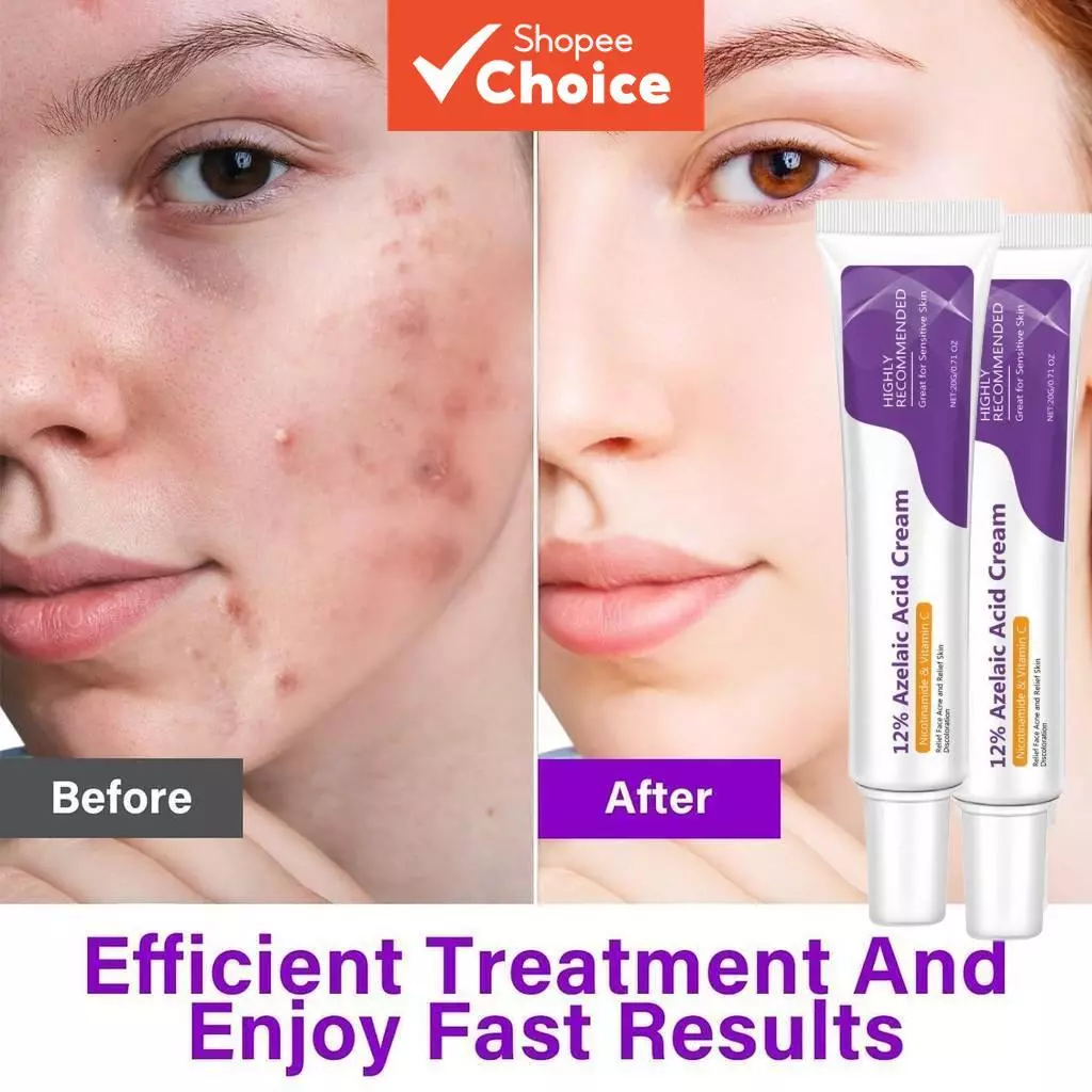 Azelaic Acid Serum: สูตรไฮยาลูโรนิก แอนด์ ไนอาซินาไมด์ ไบรท์เทนนิ่ง สกินแคร์ ของขวัญสําหรับผู้หญิง