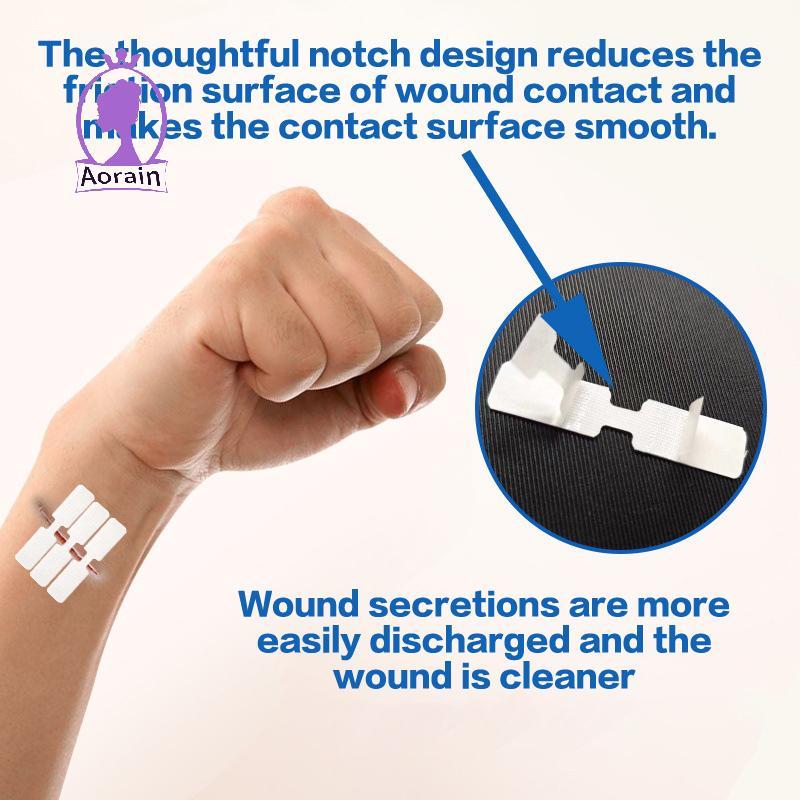 # ANTH # 10 ชิ้นซิป Band-aid ไม่เจ็บปวดอุปกรณ์ปิดแผลเย็บแผลฟรีแพทช์ปิดแผลซิปเย็บลด Band Aid.