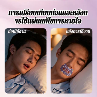🥇ซื้อ 1 แถม 1🥇【แผ่นแก้ไขการหายใจทางปากสำหรับผู้ใหญ่】เซต Anti Snoring Stickers แผ่นแปะหายใจปาก แผ่นแปะจมูกแก้ไข Breathable Mouth