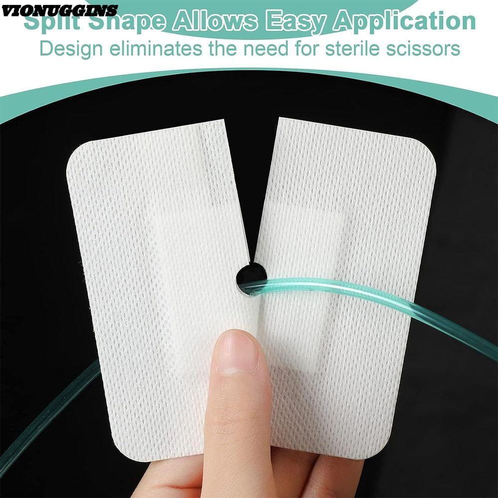 VIONUGGINS 10 ชิ้น Feeding Tube Pad, ผ้าพันแผลแผล Gtube อุปกรณ์ Chest Catheter Cover, เปลี่ยน Perito