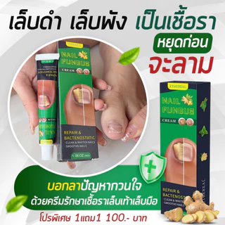 ครีมกันเชื้อราเล็บ เล็บสวย แข็งแรง สุขภาพดี