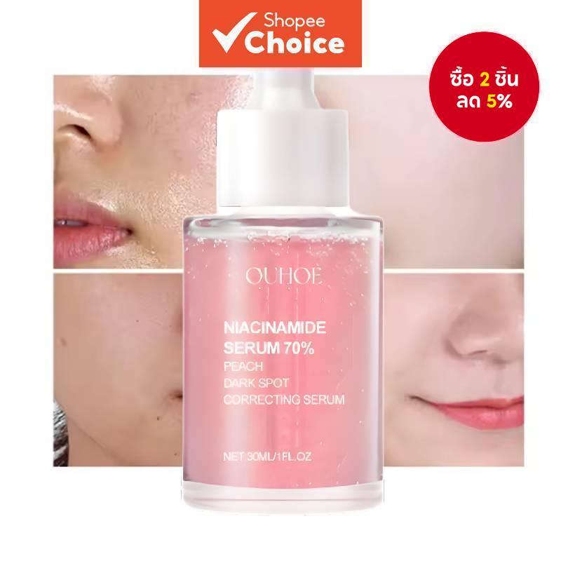 เซรั่มไนอะซินาไมด์ 70% ลดจุดด่างดํา ปรับผิวขาวกระจ่างใส ชุ่มชื้น ฟื้นฟูผิว ลดริ้วรอย กระชับรูขุมขน เอสเซนส์ดูแลผิว 30มล.