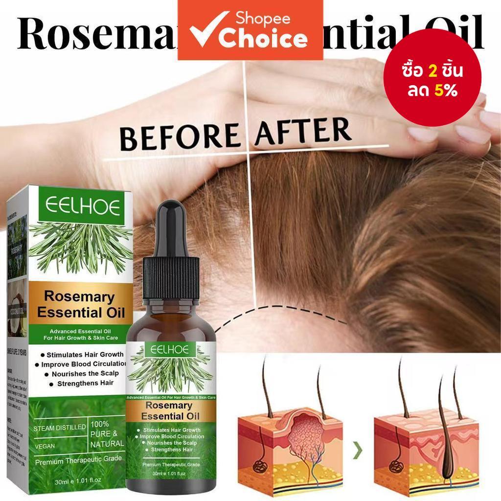 น้ํามันหอมระเหยโรสแมรี่ - Grow Hair Faster, ควบคุมความมันหนังศีรษะเพื่อ Stronger, Healthier Strands ราคาถูก Shopee Lazada